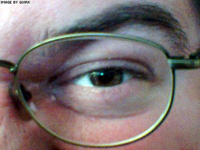 MyEye.jpg